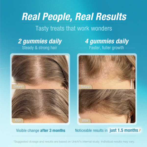 Unichi Hair Boost Gummy 60's TL0001